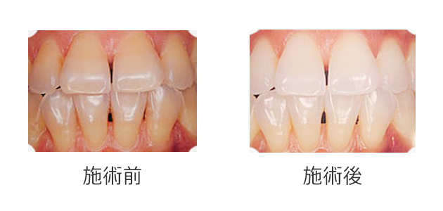 カウンセリング